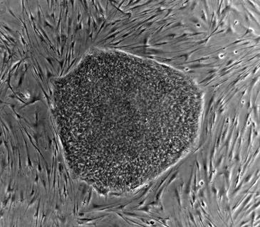 Logran convertir células de piel en células sanas de músculo cardiaco